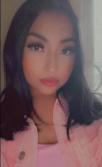 Ry'anne Bruised Head